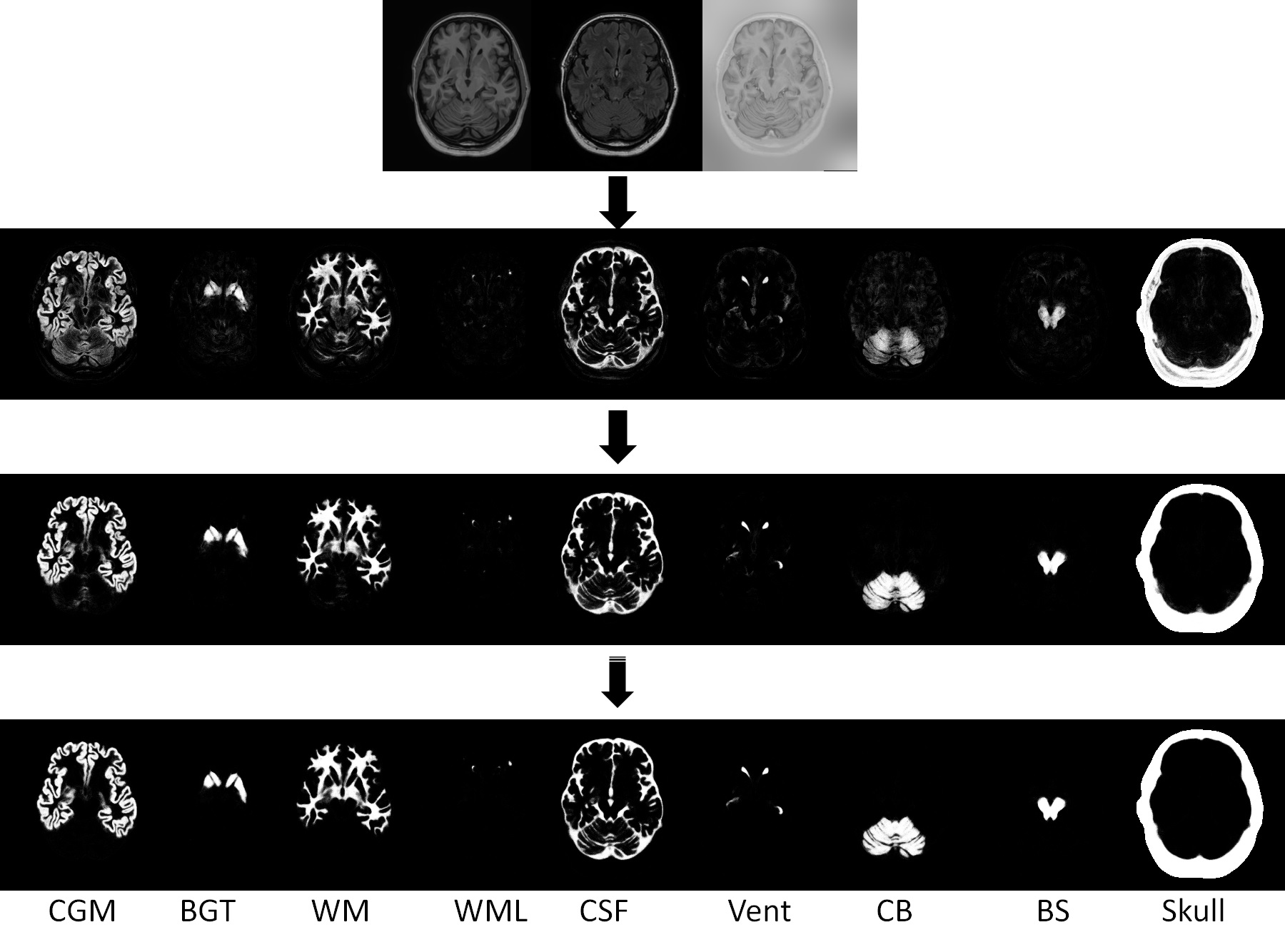 LINKS: Learning-based multi-source IntegratioN frameworK for Segmentation of infant brain images