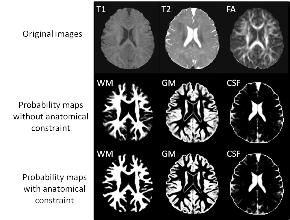 Integration of Sparse Multi-modality Representation and Geometrical Constraint for Isointense Infant Brain Segmentation